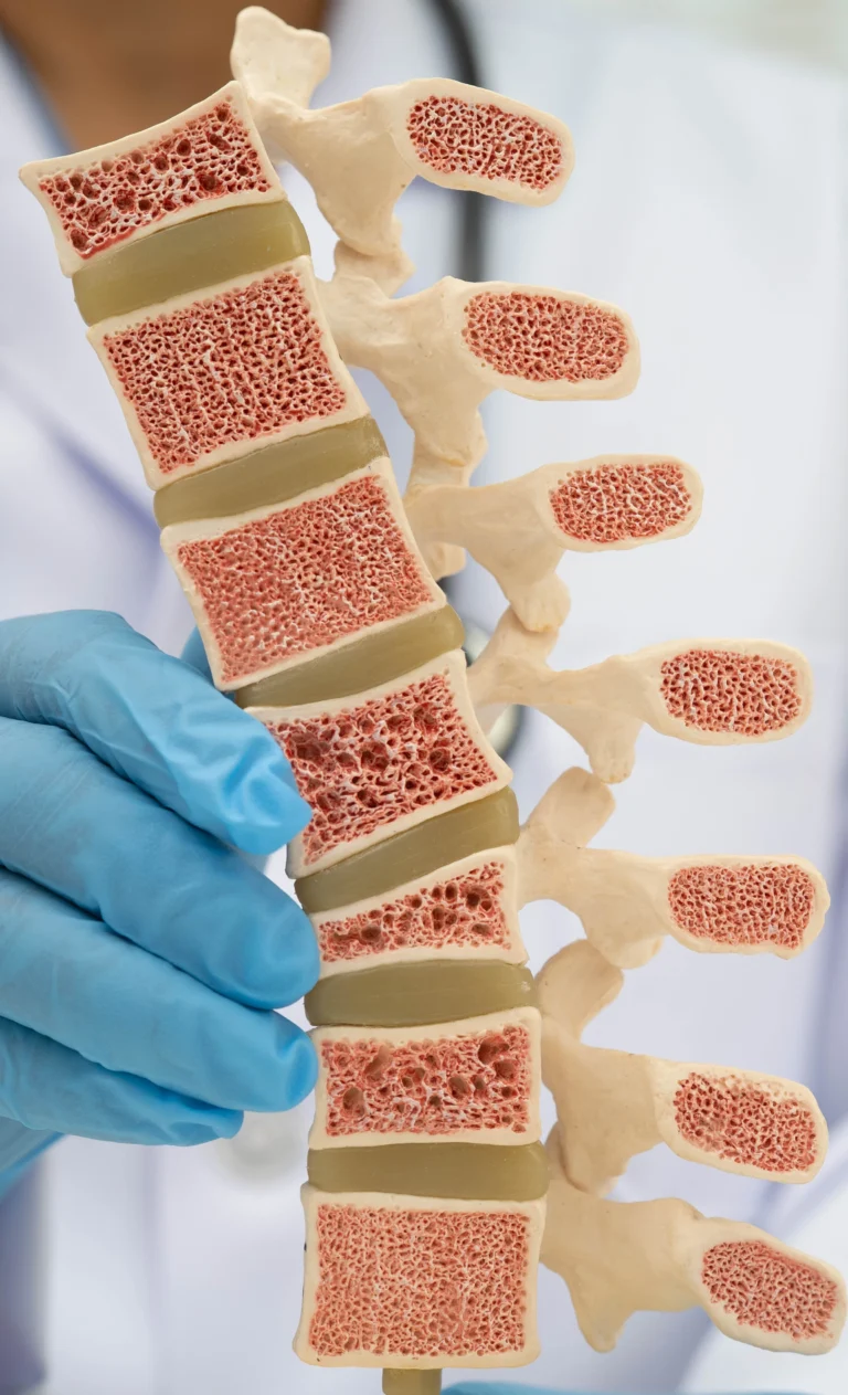 Chiropractor holding a model of the human spine
